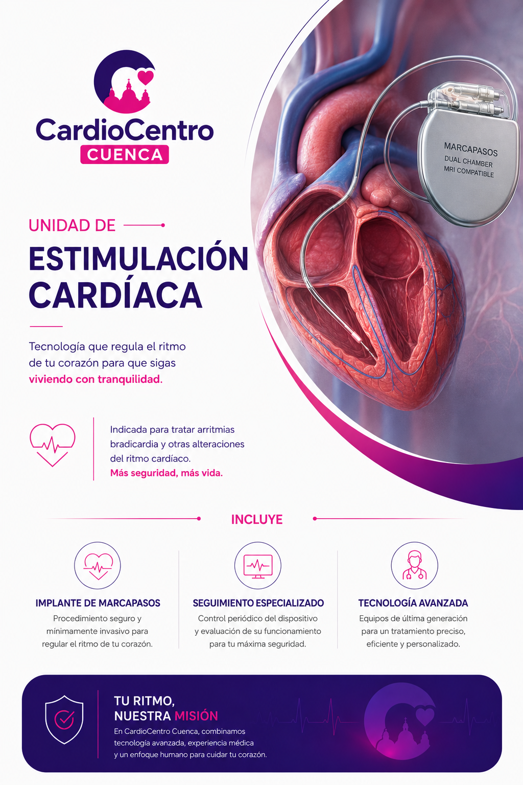 Unidad de Estimulación Cardíaca
